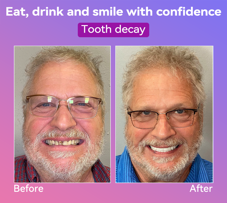 Vioralifes® Next-Generation Comfort Dentures (Luxurious dentures, lightweight and easy to wear — limited-time 70% OFF)