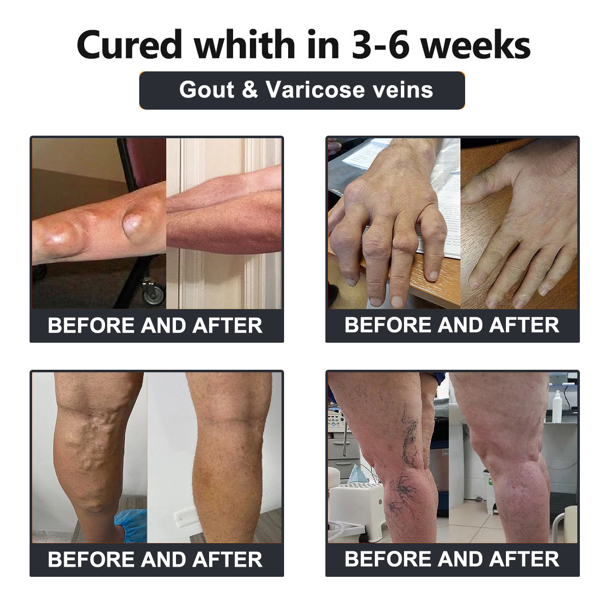 Official Store: Vioralifes™ Bee Venom and Turmeric Joint and Bone Pain Relief Cream 👨⚕️ Approved by the American Academy of Orthopaedic Surgeons (AAOS)