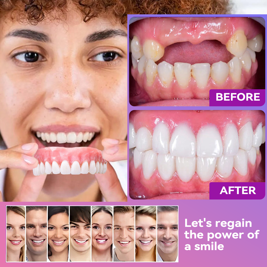 Vioralifes® Next-Generation Comfort Dentures (Luxurious dentures, lightweight and easy to wear — limited-time 70% OFF)