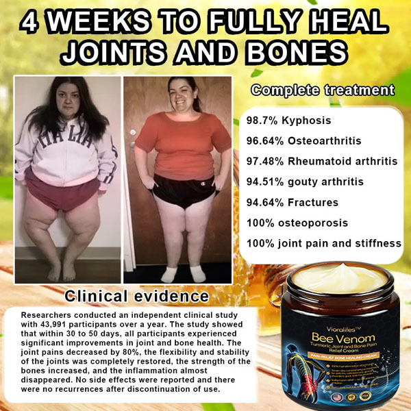 Official Store: Vioralifes™ Bee Venom and Turmeric Joint and Bone Pain Relief Cream 👨‍⚕️ Approved by the American Academy of Orthopaedic Surgeons (AAOS)