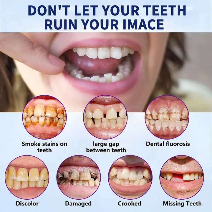 Vioralifes®-🦷Advanced Customized Full Denture Set🦷 (⏰Limited time discount last 30 minutes⏰)