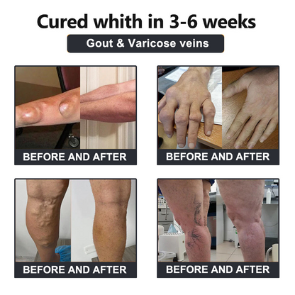 Official Store: Vioralifes™ Bee Venom and Turmeric Joint and Bone Pain Relief Cream 👨‍⚕️ Approved by the American Academy of Orthopaedic Surgeons (AAOS)