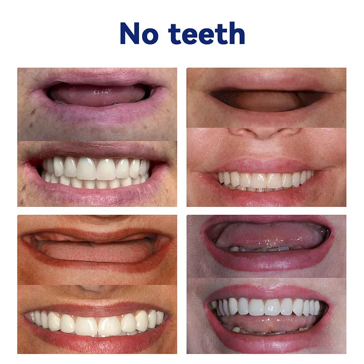 Vioralifes®-🦷Advanced Customized Full Denture Set🦷 (⏰Limited time discount last 30 minutes⏰)